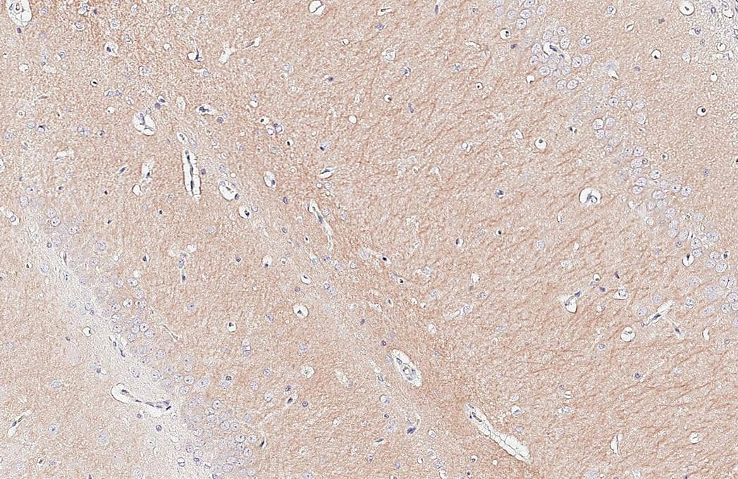 GEF-H1 antibody [HL3470] detects GEF-H1 protein by immunohistochemical analysis.Sample: Paraffin-embedded rat hippocampus.GEF-H1 stained by GEF-H1 antibody [HL3470] (NBP3-48817) diluted at 1:200.Antigen Retrieval: Citrate buffer, pH 6.0, 15 min 
