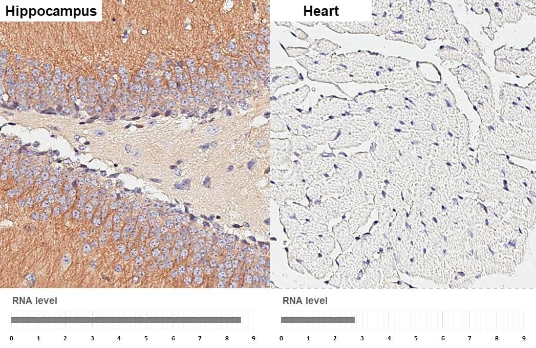 <b>Orthogonal Strategies Validation. </b>GEF-H1 antibody [HL3470] detects GEF-H1 protein by immunohistochemical analysis.Sample: Paraffin-embedded mouse tissues.GEF-H1 stained by GEF-H1 antibody [HL3470] (NBP3-48817) diluted at 1:200.Antigen Retrieval: Citrate buffer, pH 6.0, 15 minCorresponding RNA levels (RPKM) in the tissues are based on NCBI database. 