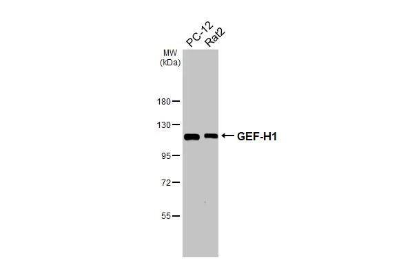 Various whole cell extracts (30 ug) were separated by 7.5% SDS-PAGE, and the membrane was blotted with GEF-H1 antibody [HL3470] (NBP3-48817) diluted at 1:1000. The HRP-conjugated anti-rabbit IgG antibody was used to detect the primary antibody. 