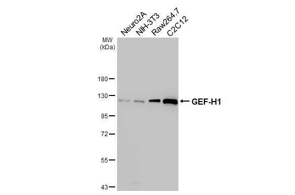Various whole cell extracts (30 ug) were separated by 7.5% SDS-PAGE, and the membrane was blotted with GEF-H1 antibody [HL3470] (NBP3-48817) diluted at 1:1000. The HRP-conjugated anti-rabbit IgG antibody was used to detect the primary antibody. 