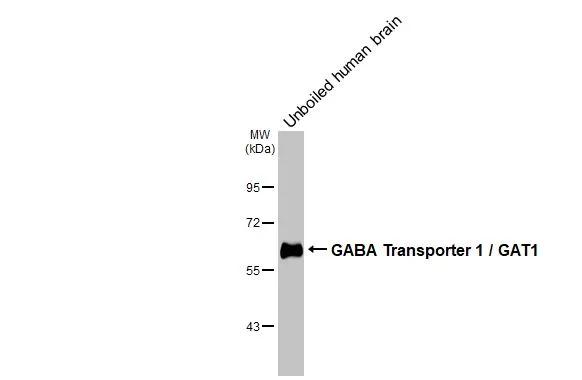 Western Blot GAT-1/SLC6A1 Antibody (HL3475)