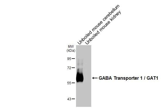 Western Blot GAT-1/SLC6A1 Antibody (HL3475)