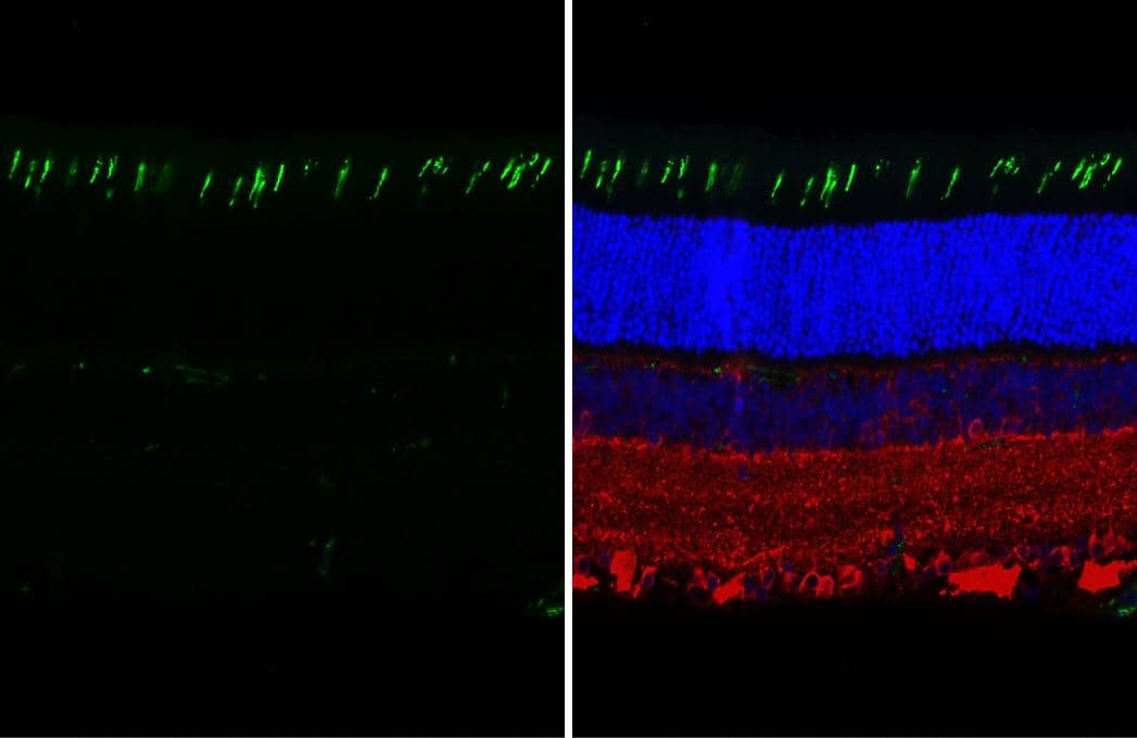 Immunohistochemistry-Paraffin Opsin 1 (Medium Wave) Antibody (HL3484)