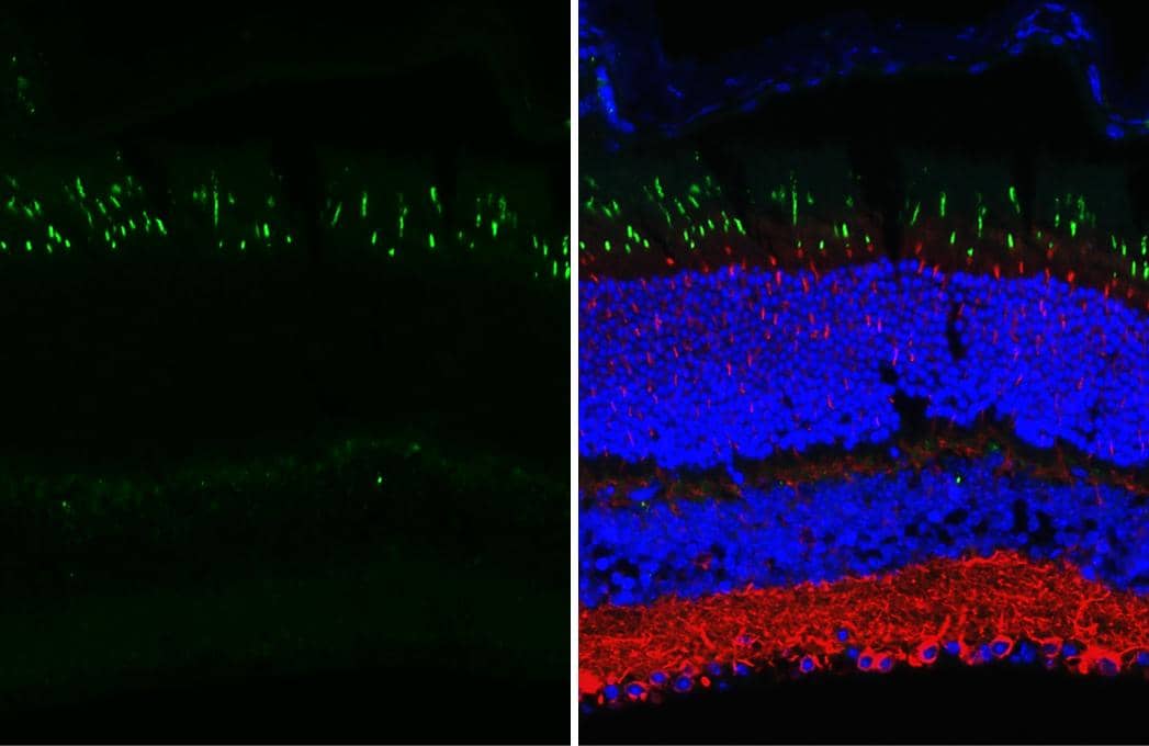Immunohistochemistry-Paraffin Opsin 1 (Medium Wave) Antibody (HL3484)