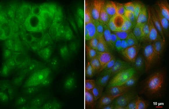 Immunocytochemistry/ Immunofluorescence ZER1 Antibody (HL3491)