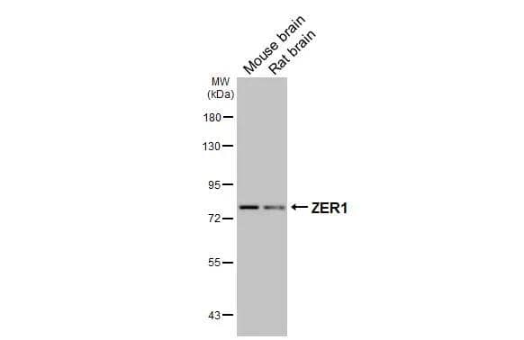Western Blot ZER1 Antibody (HL3491)