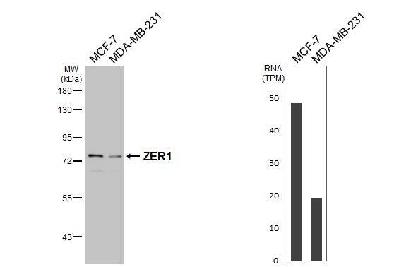 Western Blot ZER1 Antibody (HL3491)