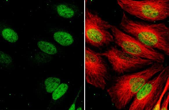 Exonuclease 1 antibody [HL3547] detects Exonuclease 1 protein by immunofluorescent analysis.Sample: HeLa cells were fixed in 4% paraformaldehyde at RT for 15 min.Green: Exonuclease 1 stained by Exonuclease 1 antibody [HL3547] (NBP3-48825) diluted at 1:500.Red: alpha Tubulin, a cytoskeleton marker, stained by alpha Tubulin antibody [GT114] diluted at 1:1000. 