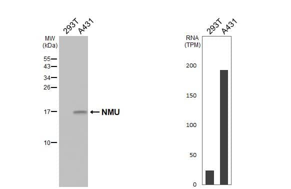 Western Blot Neuromedin-U Antibody (HL3549)