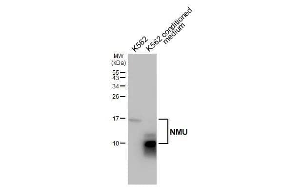 Western Blot Neuromedin-U Antibody (HL3549)