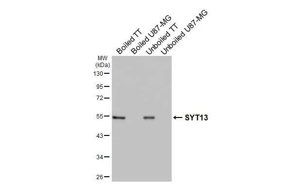 Boiled and unboiled various whole cell extracts (30 ug) were separated by 10% SDS-PAGE, and the membrane was blotted with Synaptotagmin 13 antibody [HL3579] (NBP3-48828) diluted at 1:1000. The HRP-conjugated anti-rabbit IgG antibody was used to detect the primary antibody. 
