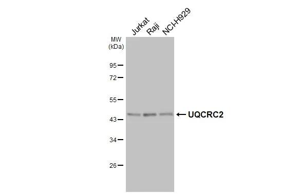 Various whole cell extracts (30 �g) were separated by 10% SDS-PAGE, and the membrane was blotted with UQCRC2 antibody [HL3638] (NBP3-48830) diluted at 1:1000. The HRP-conjugated anti-rabbit IgG antibody was used to detect the primary antibody. 