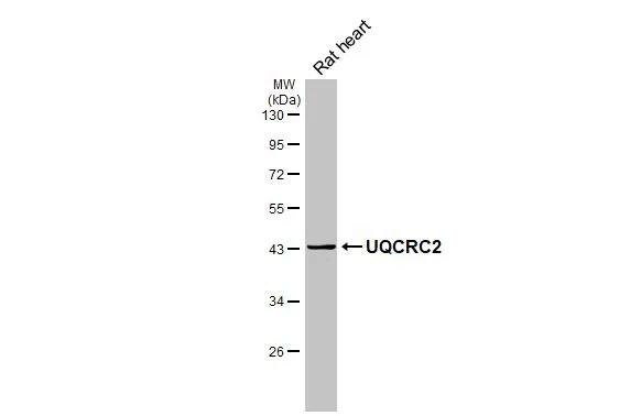 Rat tissue extract (50 �g) was separated by 10% SDS-PAGE, and the membrane was blotted with UQCRC2 antibody [HL3638] (NBP3-48830) diluted at 1:1000. The HRP-conjugated anti-rabbit IgG antibody was used to detect the primary antibody. 