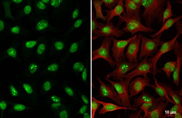 ADAR antibody [HL3666] detects ADAR protein by immunofluorescent analysis.Sample: HeLa cells were fixed in 4% paraformaldehyde at RT for 15 min.Green: ADAR stained by ADAR antibody [HL3666] (NBP3-48831) diluted at 1:500.Red: alpha Tubulin, a cytoskeleton marker, stained by alpha Tubulin antibody [GT114] diluted at 1:1000. 