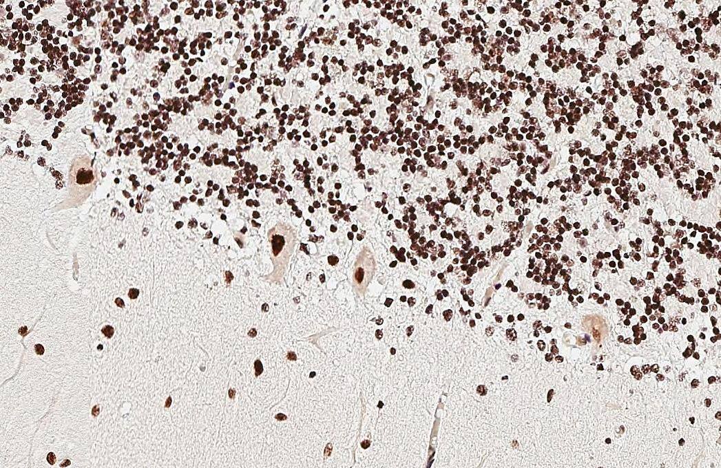 ADAR antibody [HL3666] detects ADAR protein by immunohistochemical analysis.Sample: Paraffin-embedded human cerebellum.ADAR stained by ADAR antibody [HL3666] (NBP3-48831) diluted at 1:200.Antigen Retrieval: Tris-EDTA buffer, pH 9.0, 15 min 