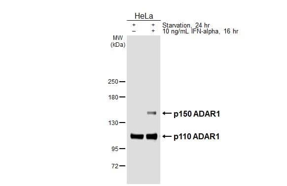 Untreated (-) and treated (+) HeLa whole cell extracts (30 ug) were separated by 5% SDS-PAGE, and the membrane was blotted with ADAR antibody [HL3666] (NBP3-48831) diluted at 1:1000. The HRP-conjugated anti-rabbit IgG antibody was used to detect the primary antibody. 