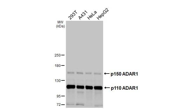 Various whole cell extracts (30 ug) were separated by 5% SDS-PAGE, and the membrane was blotted with ADAR antibody [HL3666] (NBP3-48831) diluted at 1:1000. The HRP-conjugated anti-rabbit IgG antibody was used to detect the primary antibody. 