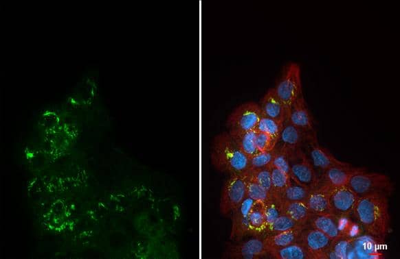 ORP8 antibody [HL3673] detects ORP8 protein by immunofluorescent analysis.Sample: A431 cells were fixed in ice-cold MeOH for 5 min.Green: ORP8 stained by ORP8 antibody [HL3673] (NBP3-48832) diluted at 1:500.Red: alpha Tubulin, a cytoskeleton marker, stained by alpha Tubulin antibody [GT114] diluted at 1:1000.Blue: Fluoroshield with DAPI . 