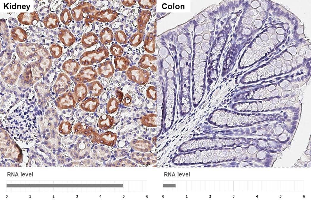 Immunohistochemistry-Paraffin ORP8 Antibody (HL3673)
