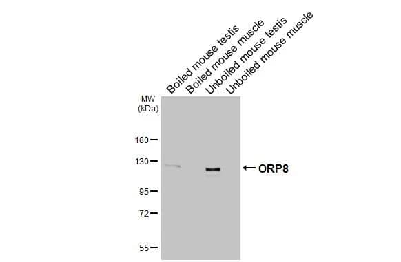 Western Blot ORP8 Antibody (HL3673)