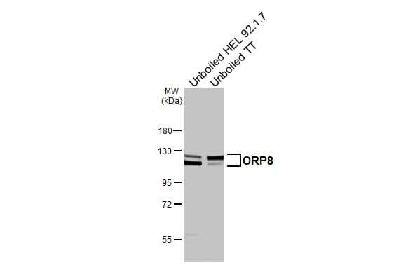 Western Blot ORP8 Antibody (HL3673)