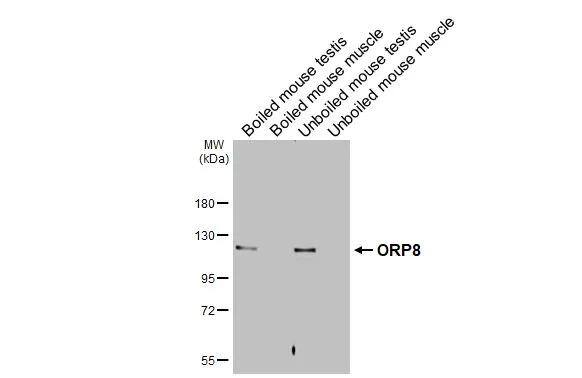 Boiled and unboiled various tissue extracts (50 ug) were separated by 7.5% SDS-PAGE, and the membrane was blotted with ORP8 antibody [HL3674] (NBP3-48833) diluted at 1:1000. The HRP-conjugated anti-rabbit IgG antibody was used to detect the primary antibody. 