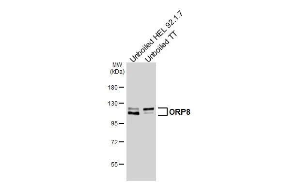 <b>Orthogonal Strategies Validation. </b>Unboiled various whole cell extracts (30 ug) were separated by 7.5% SDS-PAGE, and the membrane was blotted with ORP8 antibody [HL3674] (NBP3-48833) diluted at 1:1000. The HRP-conjugated anti-rabbit IgG antibody was used to detect the primary antibody. 