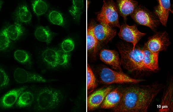 DHCR7 antibody [HL3685] detects DHCR7 protein by immunofluorescent analysis.Sample: MCF-7 cells were fixed in ice-cold MeOH for 5 min.Green: DHCR7 stained by DHCR7 antibody [HL3685] (NBP3-48834) diluted at 1:500.Red: alpha Tubulin, a cytoskeleton marker, stained by alpha Tubulin antibody [GT114] diluted at 1:1000.Blue: Fluoroshield with DAPI . 