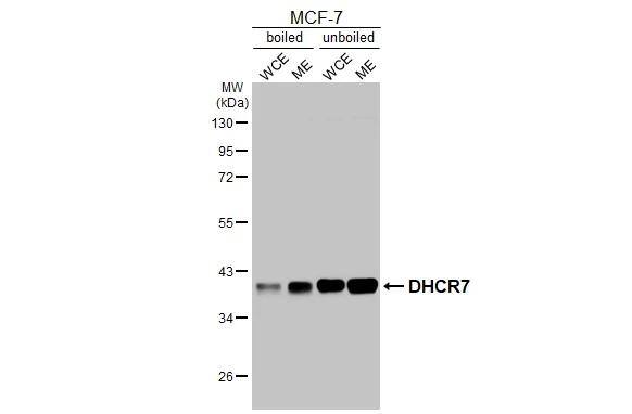 Boiled and unboiled MCF-7 whole cell extract (30 ug) were separated by 10% SDS-PAGE, and the membrane was blotted with DHCR7 antibody [HL3685] (NBP3-48834) diluted at 1:1000. The HRP-conjugated anti-rabbit IgG antibody 