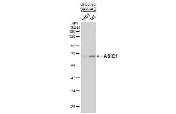Unboiled SK-N-AS whole cell and membrane extracts (30 ug) were separated by 10% SDS-PAGE, and the membrane was blotted with ACCN2 antibody [GT73] (NBP3-48835) diluted at 1:1000. The HRP-conjugated anti-mouse IgG antibody 