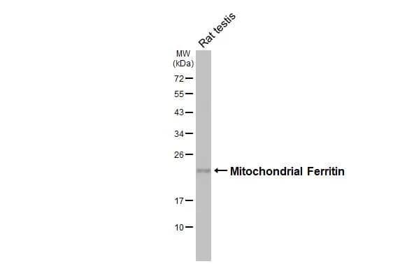 Rat tissue extract (50 ug) was separated by 12% SDS-PAGE, and the membrane was blotted with Ferritin mitochondrial antibody [HL3687] (NBP3-48836) diluted at 1:1000. The HRP-conjugated anti-rabbit IgG antibody was used to detect the primary antibody. 