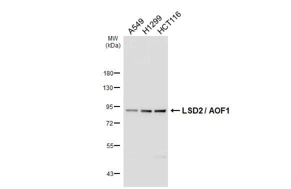 Various whole cell extracts (30 ug) were separated by 7.5% SDS-PAGE, and the membrane was blotted with AOF1 antibody [HL3728] (NBP3-48838) diluted at 1:1000. The HRP-conjugated anti-rabbit IgG antibody was used to detect the primary antibody. 