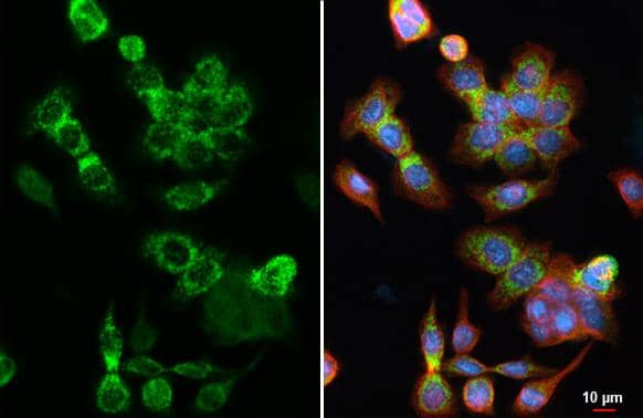HKDC1 antibody [HL3743] detects HKDC1 protein at mitochondria by immunofluorescent analysis.Sample: AsPC-1 cells were fixed in ice-cold MeOH for 5 min.Green: HKDC1 stained by HKDC1 antibody [HL3743] (NBP3-48840) diluted at 1:500.Red: alpha Tubulin, a cytoskeleton marker, stained by alpha Tubulin antibody [GT114] diluted at 1:1000.Blue: Fluoroshield with DAPI . 