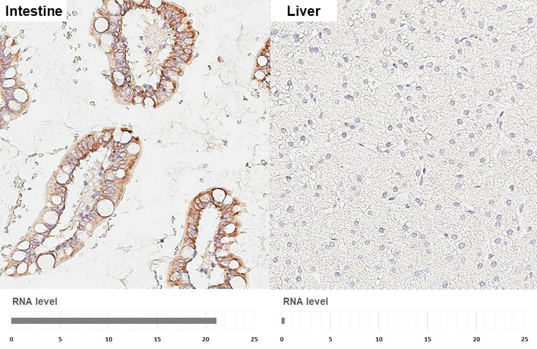 <b>Orthogonal Strategies Validation. </b>HKDC1 antibody [HL3743] detects HKDC1 protein by immunohistochemical analysis.Sample: Paraffin-embedded human tissues.HKDC1 stained by HKDC1 antibody [HL3743] (NBP3-48840) diluted at 1:200.Antigen Retrieval: Citrate buffer, pH 6.0, 15 min 