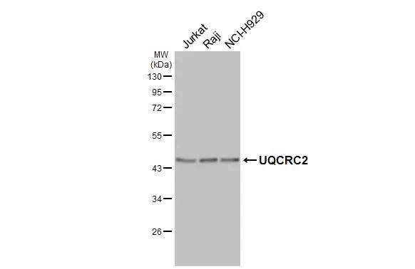 Various whole cell extracts (30 �g) were separated by 10% SDS-PAGE, and the membrane was blotted with UQCRC2 antibody [HL3749] (NBP3-48841) diluted at 1:1000. The HRP-conjugated anti-rabbit IgG antibody was used to detect the primary antibody. 