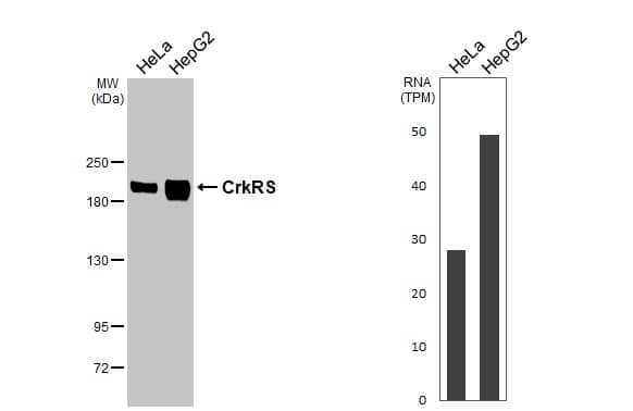 Western Blot CDK12 Antibody (HL3756)
