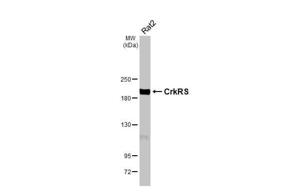 Western Blot CDK12 Antibody (HL3756)