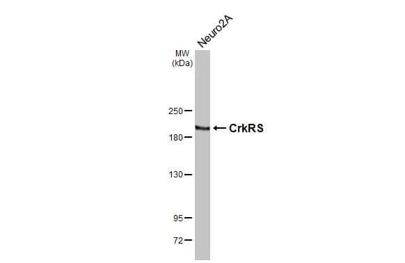Western Blot CDK12 Antibody (HL3756)