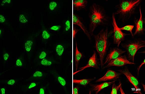 Immunocytochemistry/ Immunofluorescence CDK12 Antibody (HL3757)
