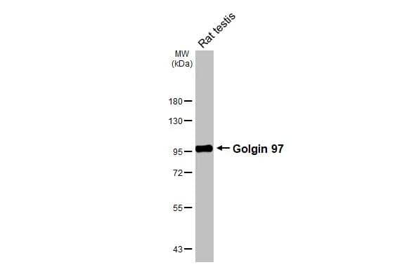 Rat tissue extract (50 �g) was separated by 7.5% SDS-PAGE, and the membranes were blotted with Golgin 97 antibody [HL3788] (NBP3-48847) diluted at 1:1000. The HRP-conjugated anti-rabbit IgG antibody was used to detect the primary antibody. 