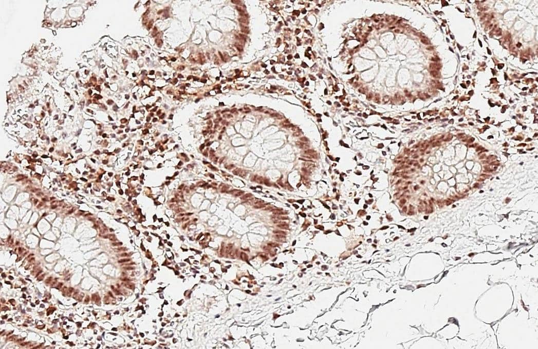 Aly antibody [HL3813] detects Aly protein by immunohistochemical analysis.Sample: Paraffin-embedded human colon.Aly stained by Aly antibody [HL3813] (NBP3-48848) diluted at 1:200.Antigen Retrieval: Tris-EDTA buffer, pH 9.0, 15 min 