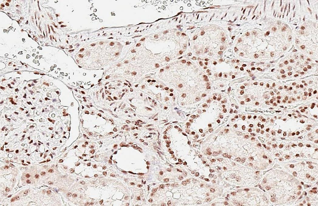 Aly antibody [HL3813] detects Aly protein by immunohistochemical analysis.Sample: Paraffin-embedded human kidney.Aly stained by Aly antibody [HL3813] (NBP3-48848) diluted at 1:200.Antigen Retrieval: Tris-EDTA buffer, pH 9.0, 15 min 