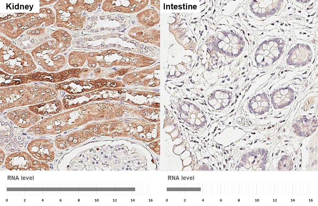 <b>Orthogonal Strategies Validation. </b>PATJ antibody [HL3842] detects PATJ protein by immunohistochemical analysis.Sample: Paraffin-embedded human tissues.PATJ stained by PATJ antibody [HL3842] (NBP3-48849) diluted at 1:200.Antigen Retrieval: Citrate buffer, pH 6.0, 15 min 