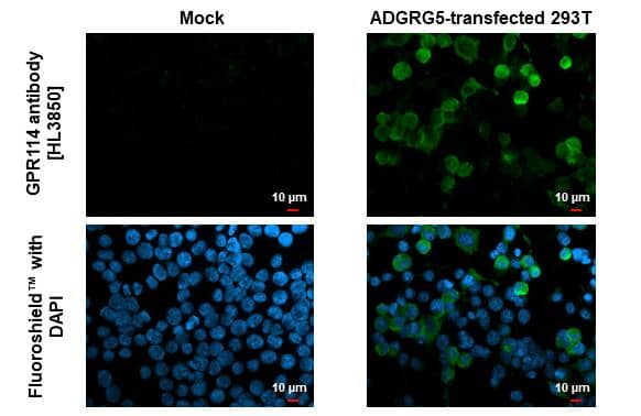 GPR114 antibody [HL3850] detects GPR114 protein by immunofluorescent analysis.Sample: Mock and transfected 293T cells were fixed in ice-cold MeOH for 5 min.Green: GPR114 stained by GPR114 antibody [HL3850] (NBP3-48850) diluted at 1:500.Blue: Fluoroshield with DAPI . 