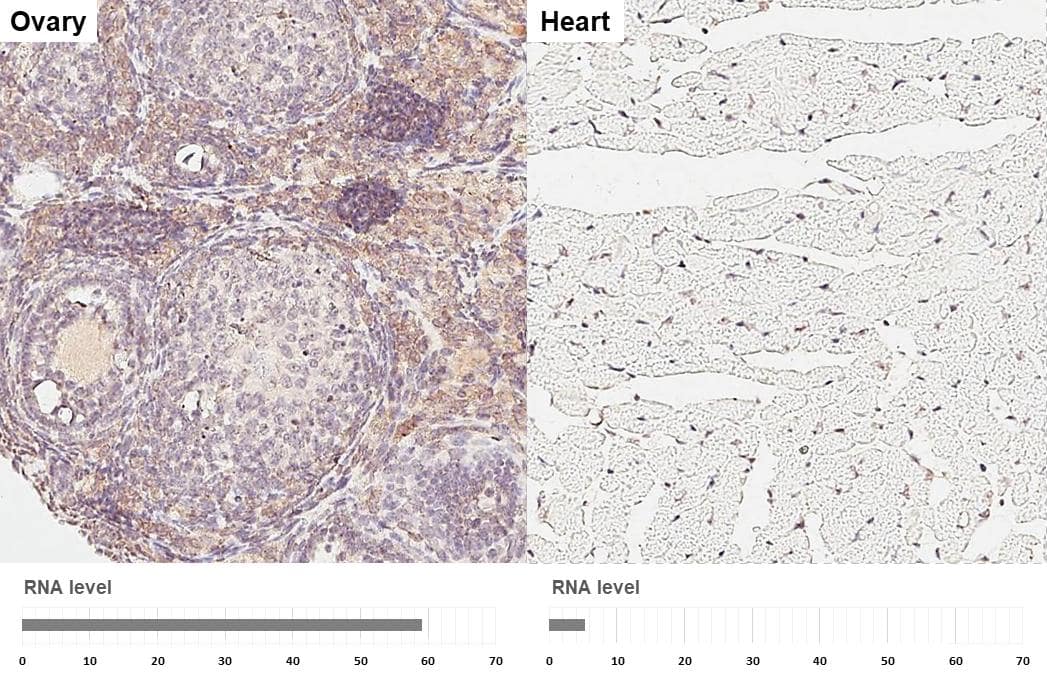 DHCR7 antibody [HL3854] detects DHCR7 protein by immunohistochemical analysis.Sample: Paraffin-embedded mouse tissues.DHCR7 stained by DHCR7 antibody [HL3854] (NBP3-48851) diluted at 1:200.Antigen Retrieval: Tris-EDTA buffer, pH 9.0, 15 min 