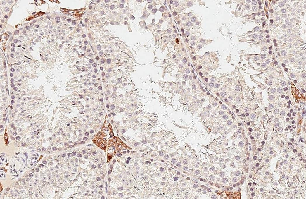 DHCR7 antibody [HL3854] detects DHCR7 protein by immunohistochemical analysis.Sample: Paraffin-embedded mouse testis.DHCR7 stained by DHCR7 antibody [HL3854] (NBP3-48851) diluted at 1:200.Antigen Retrieval: Tris-EDTA buffer, pH 9.0, 15 min 