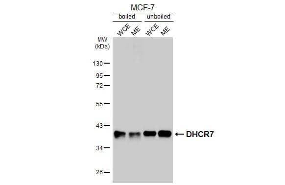 Boiled and unboiled MCF-7 whole cell and membrane extracts (30 ug) were separated by 10% SDS-PAGE, and the membrane was blotted with DHCR7 antibody [HL3854] (NBP3-48851) diluted at 1:1000. The HRP-conjugated anti-rabbit IgG antibody 