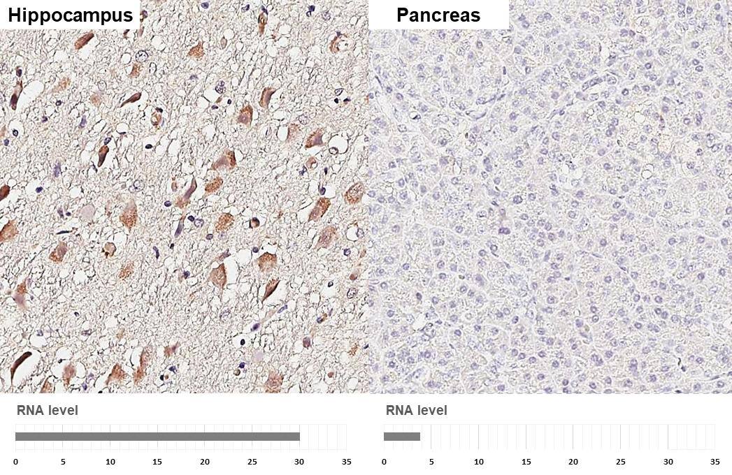 Immunohistochemistry-Paraffin 5-HT1E Antibody (HL3875)