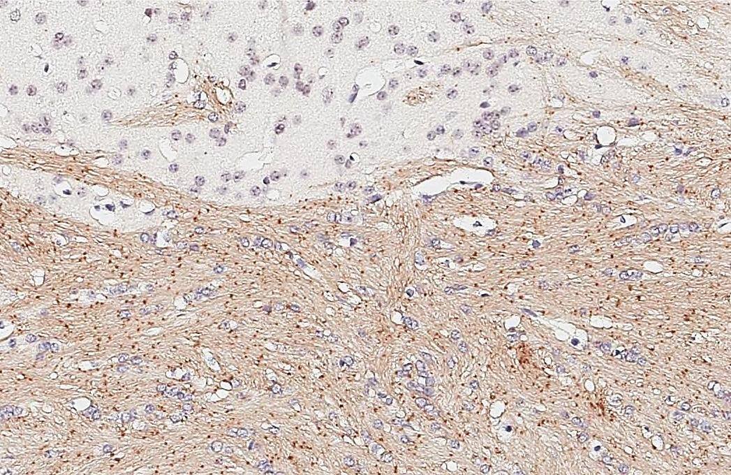 Immunohistochemistry-Paraffin HAPLN2 Antibody (GT107)