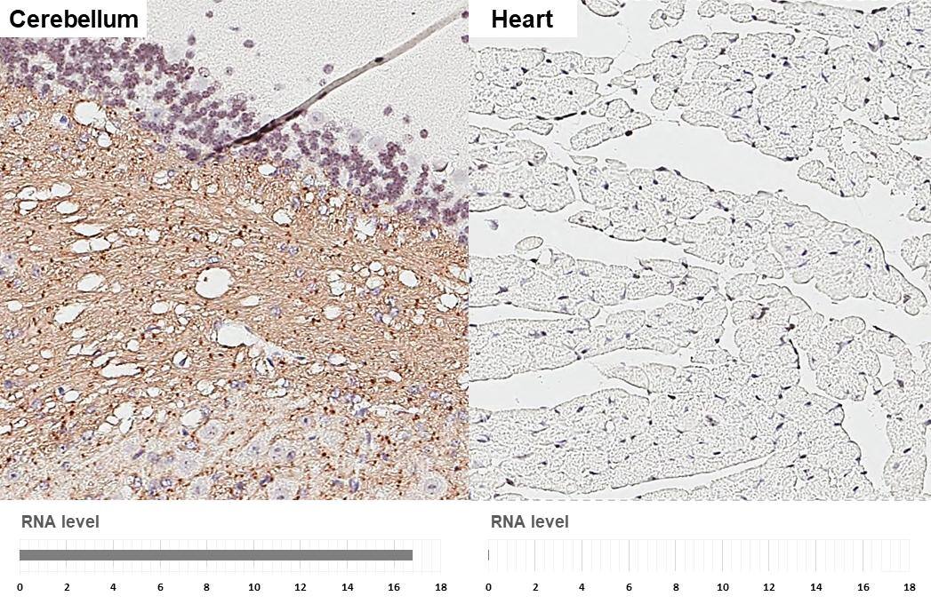 Immunohistochemistry-Paraffin HAPLN2 Antibody (GT107)